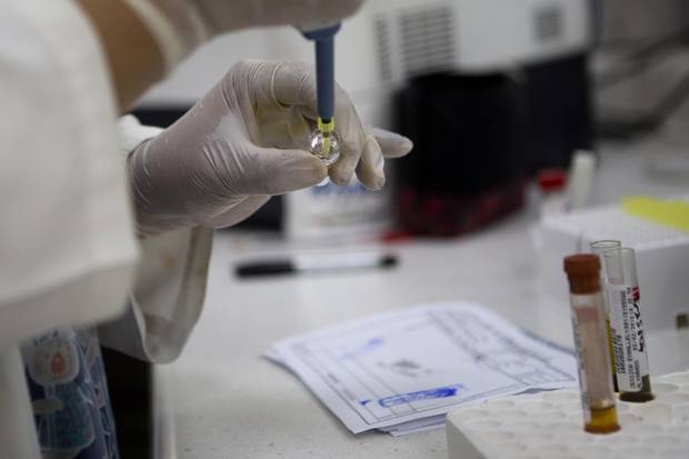 Blood samples from pregnant women are analyzed for the presence of the Zika virus, at Guatemalan Social Security maternity hospital in Guatemala City, Tuesday, Feb. 2, 2016.