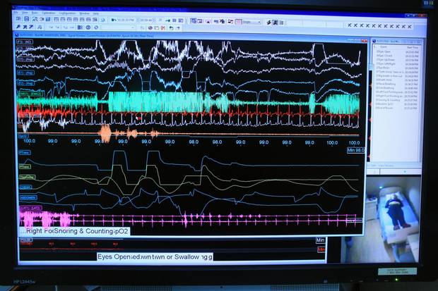 A monitor displays Globe and Mail writer Erin Anderssen's status during a sleep disorder test at the Royal Ottawa Hospital Sleep Lab November 7, 2016 in Ottawa.