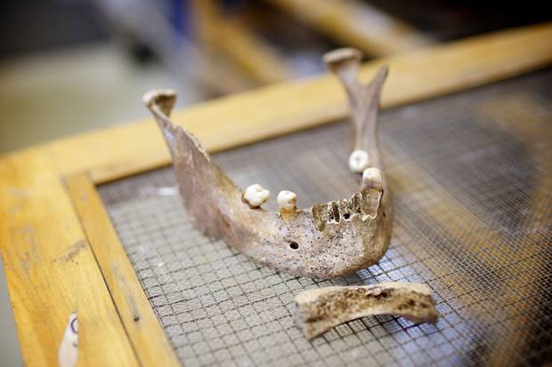 The military man’s jaw, with some teeth still attached.