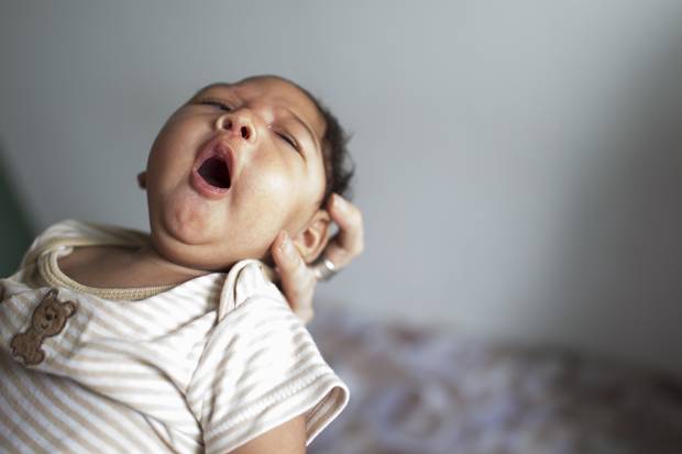 In Oct. 2015, the health department in the Brazilian state of Pernambuco issued an alert to doctors, reporting a spike in babies with brain defects causing microcephaly. Here, Samuel Amorim, 2 months, waits in a clinic in the state of Paraiba for therapy for the condition.