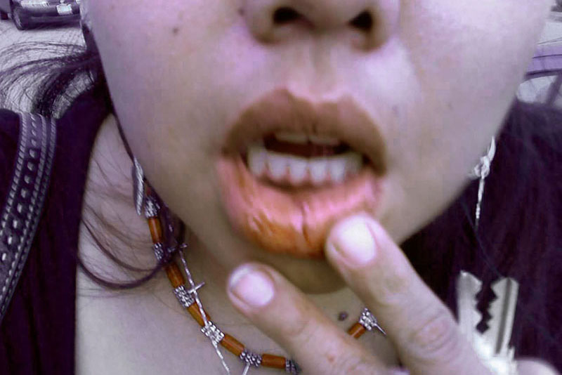 A photo of Angeline’s split lip that she posted to Facebook after a fight with her fiancé Robert Calden. She went missing shortly after. Photo courtesy Cary-Lee Calder