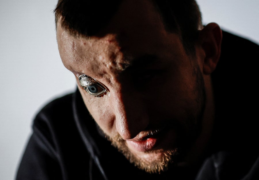 Andrii Onopriienko, blinded by Russian fire in 2023, took up acting with Veterans’ Theatre in Kyiv. ‘It’s rehabilitation and socialization,’ he explains.